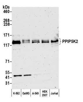 Rabbit anti-PPIP5K2 Antibody