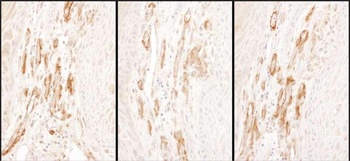 Rabbit anti-Caldesmon Antibody