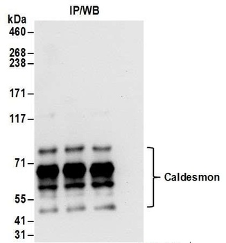 Rabbit anti-Caldesmon Antibody