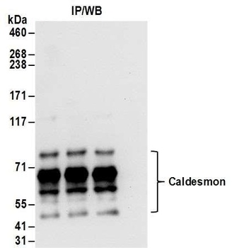 Rabbit anti-Caldesmon Antibody
