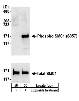 Rabbit anti-Phospho SMC1 (S957) Antibody