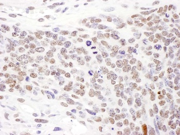 Rabbit anti-Phospho SMC1 (S957) Antibody