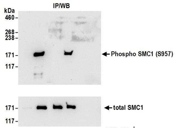 SMC1, Phospho (S957) Antibody