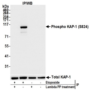 KAP-1, Phospho (S824) Antibody