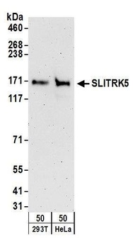 Rabbit SLITRK5 Antibody