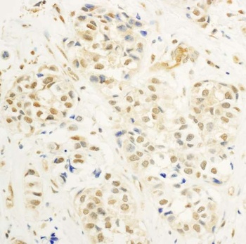 Rabbit c-Myb Antibody