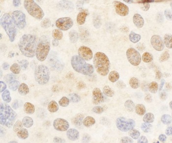 Rabbit anti-c-Myb Antibody