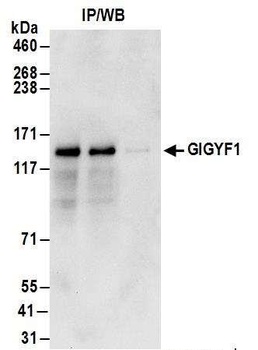 Rabbit anti-GIGYF1 Antibody