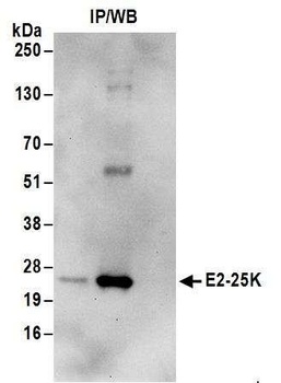 E2-25K Antibody