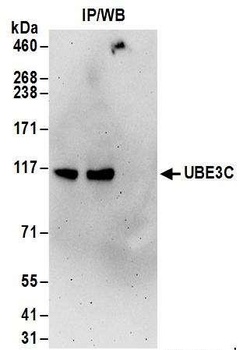 UBE3C Antibody