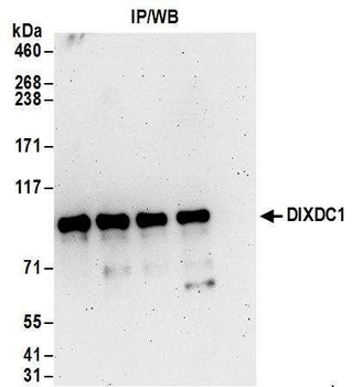 DIXDC1 Antibody