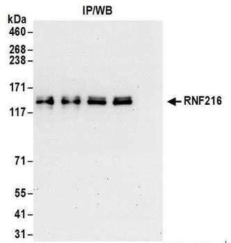 Rabbit RNF216 Antibody