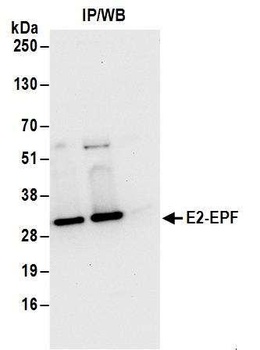 Rabbit E2-EPF Antibody