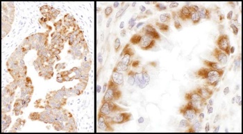 Rabbit anti-IDH2 Antibody