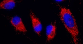 Rabbit anti-IDH2 Antibody