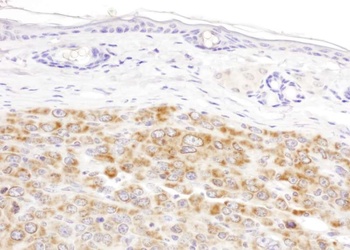 Rabbit anti-IDH2 Antibody