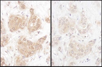 Rabbit anti-WWOX Antibody