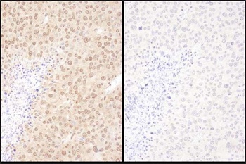 Rabbit anti-WWOX Antibody
