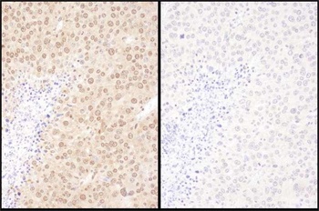 Rabbit anti-WWOX Antibody
