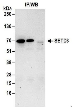 SETD3 Antibody