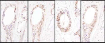 Rabbit HNF1-alpha Antibody