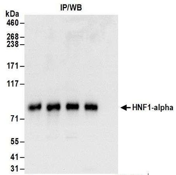 HNF1-alpha Antibody