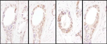 Rabbit HNF1-alpha Antibody