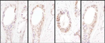 Rabbit HNF1-alpha Antibody