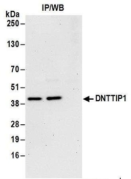 DNTTIP1 Antibody