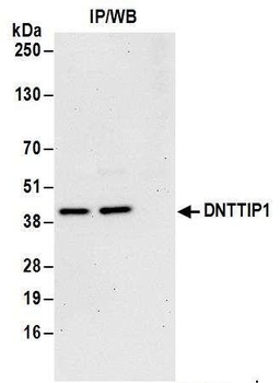 Rabbit anti-DNTTIP1 Antibody