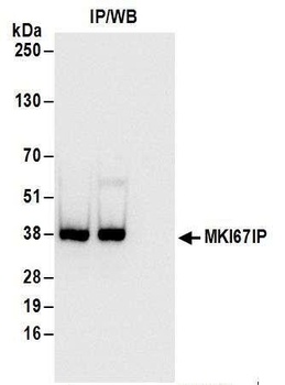 MKI67IP Antibody