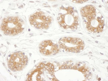 Rabbit anti-TMX1 Antibody