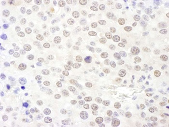 NHP2L1 Antibody