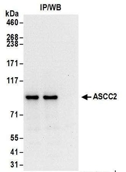 ASCC2 Antibody