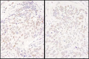 Rabbit anti-DENTT Antibody