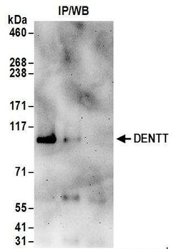 Rabbit anti-DENTT Antibody