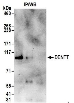 DENTT Antibody