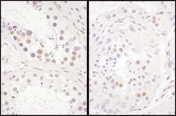 Rabbit anti-DENTT Antibody