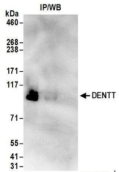 Rabbit anti-DENTT Antibody