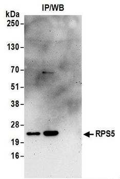 Rabbit anti-RPS5 Antibody