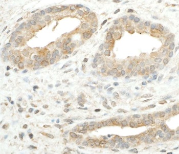 RPS5 Antibody