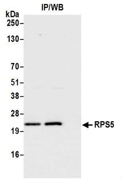 RPS5 Antibody