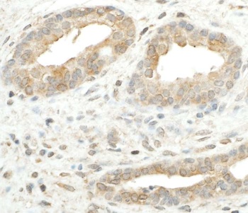 Rabbit anti-RPS5 Antibody