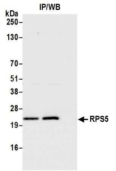Rabbit anti-RPS5 Antibody