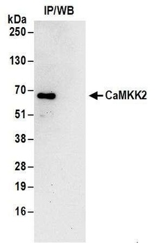 CaMKK2 Antibody