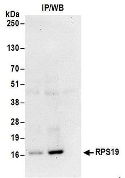 RPS19 Antibody