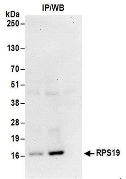 Rabbit anti-RPS19 Antibody