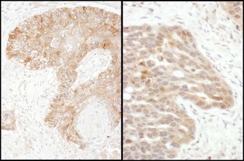 Rabbit anti-TS Antibody