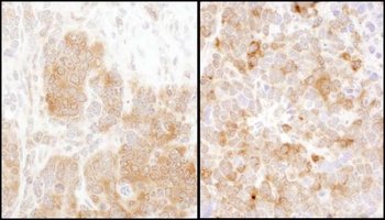 Rabbit anti-TS Antibody