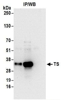 TS Antibody